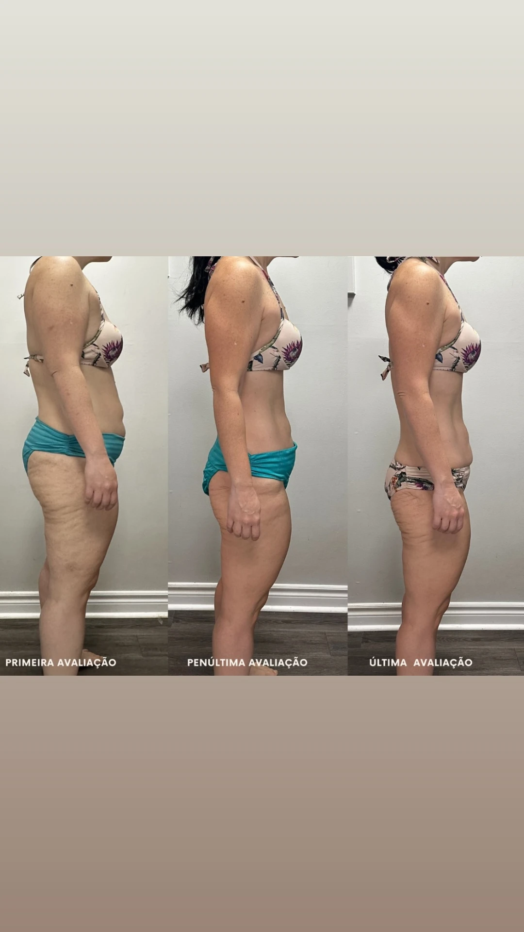 Antes e depois de aluna da Consultoria SempreMagra 5